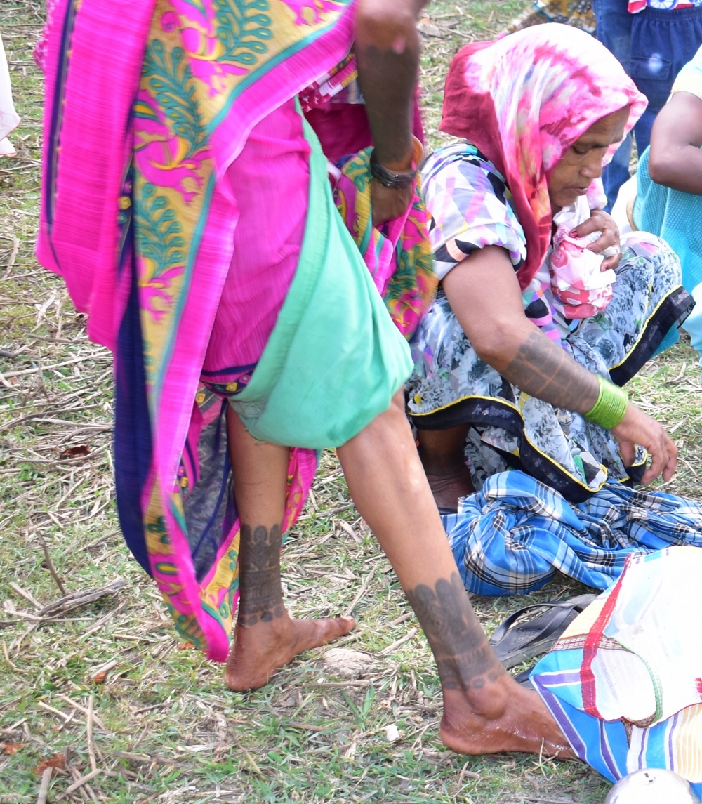 A woman with godna on her calves